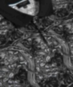 Archsupport.shoped03c15340 3